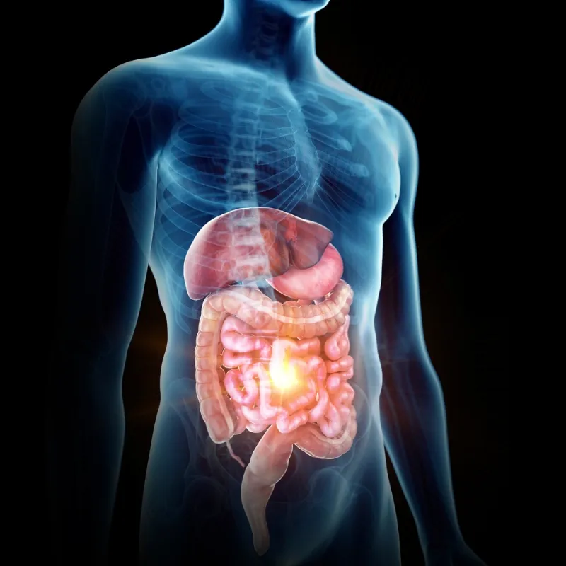 Gastrointestinal Disorder